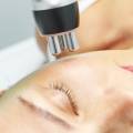 Radiofrecuencia estética: rejuvenecimiento facial y corporal en Alicante