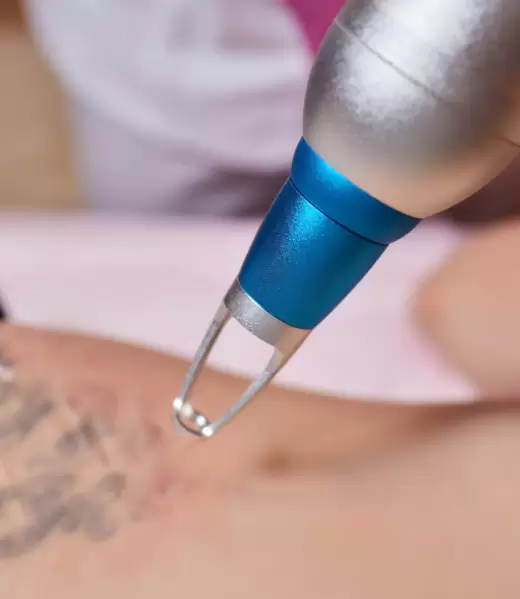 aparatologia estetica en alicante (1)